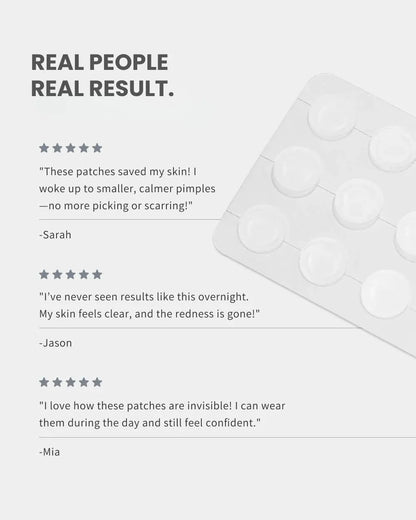 exmose ClearDot™