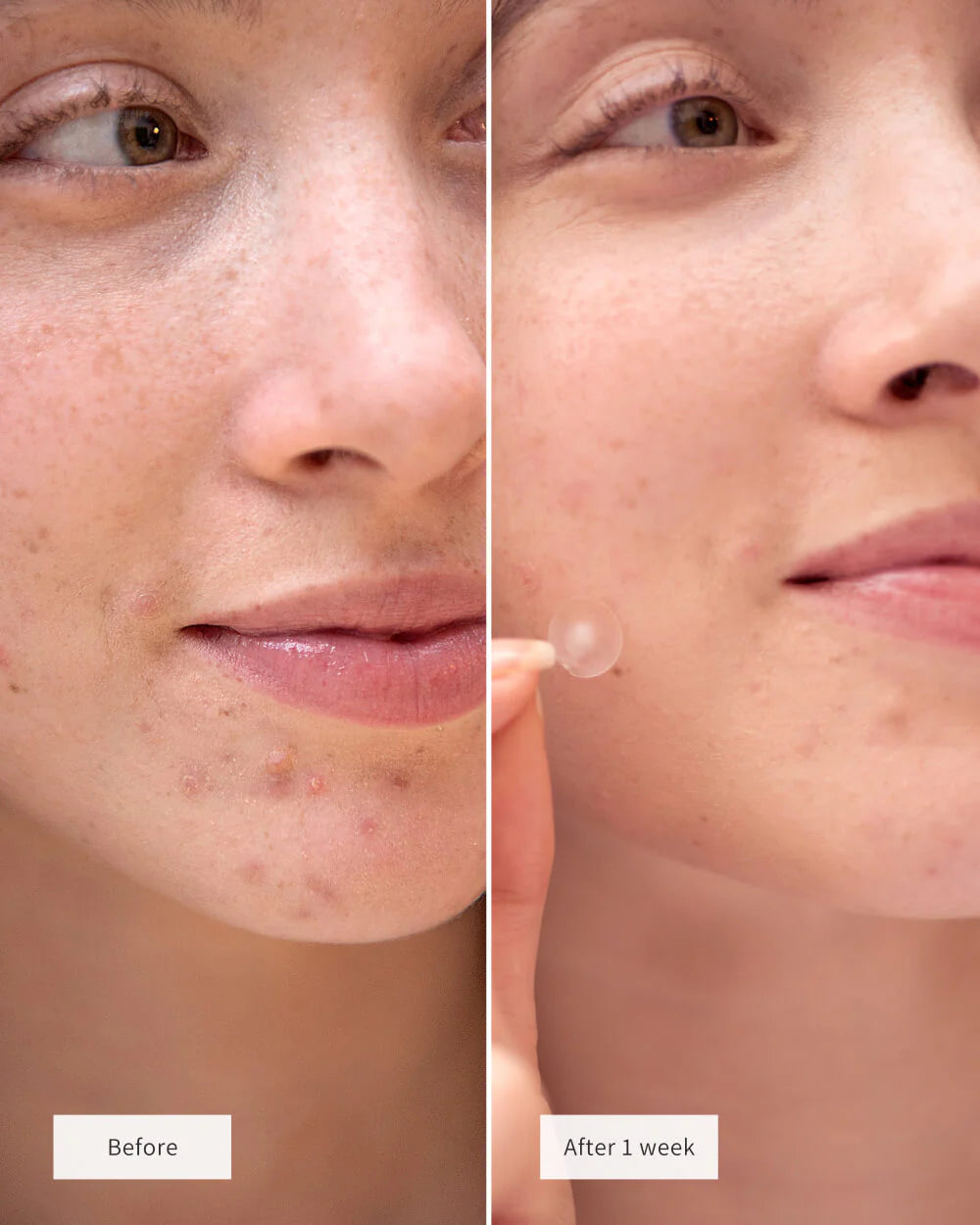 exmose ClearDot™