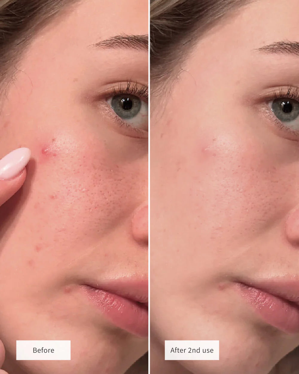 exmose ClearDot™