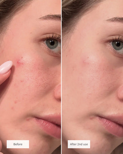 exmose ClearDot™