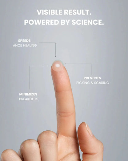 exmose ClearDot™