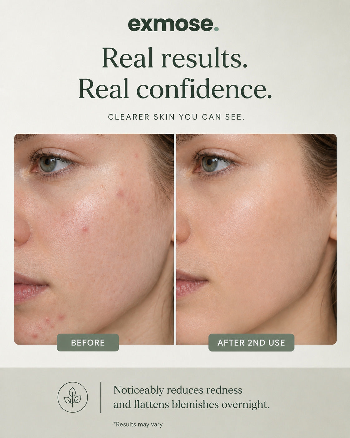 exmose ClearDot™